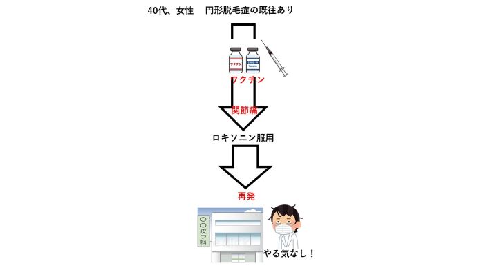 円形脱毛症　病院